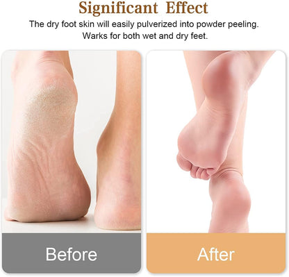 Glass Foot File Callus Remover, Innovative Nano Crystal Feet Scrubber for Travel Use, Portable Pedicure Foot Scraper for Cracked Heel (Normal)