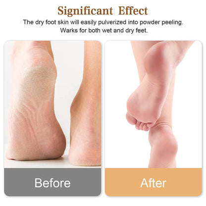 Glass Foot File Callus Remover, Innovative Nano Crystal Feet Scrubber for Travel Use, Portable Pedicure Foot Scraper for Cracked Heel (Normal)